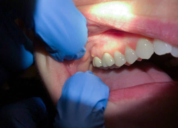 Best Emergency TMJ Treatment in Mankato, MN