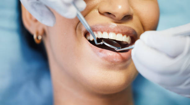 Best Emergency Treatment for Dental Infections or Abscesses in Mankato, MN