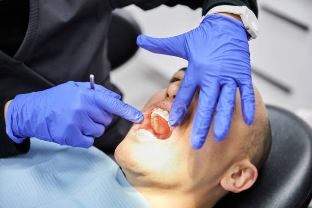 Best Emergency Gum Treatment in Mankato, MN